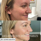 Crème 3D Lifting Coréenne