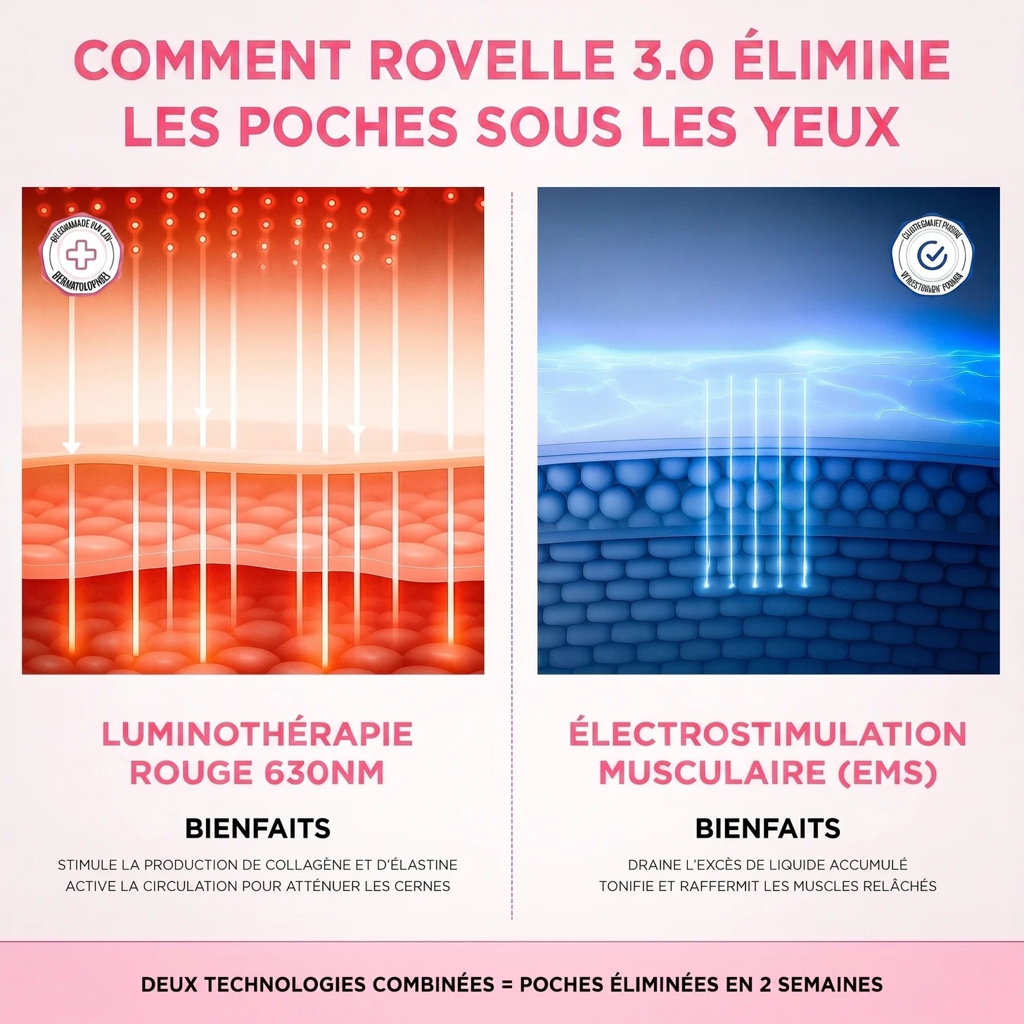 Comment Rovelle 3.0 élimine les poches