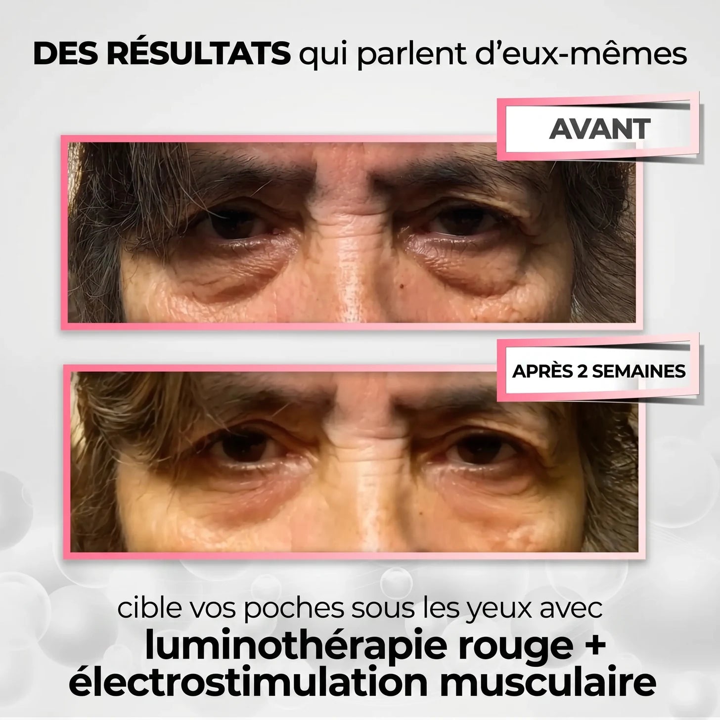 Résultats avant / après